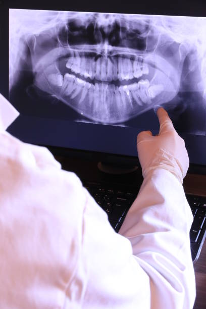 Best Emergency Dentist for Lost Fillings or Crowns in Wailua, HI
